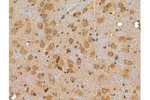 ABIN6257637 and ABIN6274779 at 1/100 staining Rat brain tissue by IHC-P.