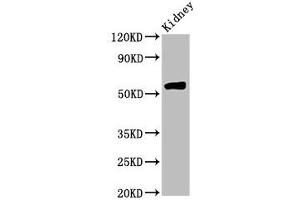 Western Blot Positive WB detected in: Rat kidney tissue All lanes: HMGCS2 antibody at 4. (HMGCS2 Antikörper  (AA 426-508))