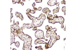 IHC analysis of MCUR1 using anti-MCUR1 antibody (ABIN6719261). (CCDC90A Antikörper)