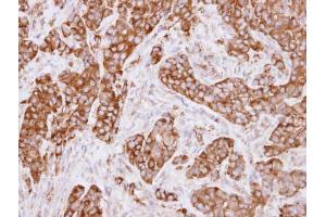 Immunohistochemistry (IHC) image for anti-Major Vault Protein (MVP) antibody (ABIN2856921)