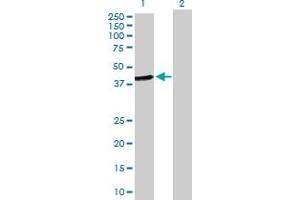 Western Blot analysis of HOMER2 expression in transfected 293T cell line by HOMER2 MaxPab polyclonal antibody. (HOMER2 Antikörper  (AA 1-343))