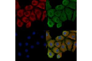 Phospho-COX IV (Ser58) Antibody staining Hela cells(heat shock treatment) by IF/ICC.