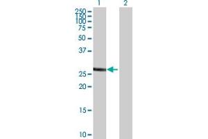 Western Blotting (WB) image for anti-Sulfotransferase Family, Cytosolic, 1A, Phenol-Preferring, Member 1 (SULT1A1) (AA 1-295) antibody (ABIN520600)