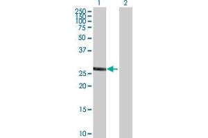Western Blot analysis of SULT1A1 expression in transfected 293T cell line by SULT1A1 MaxPab polyclonal antibody. (SULT1A1 Antikörper  (AA 1-295))