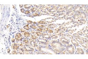 Detection of CDKN2B in Mouse Stomach Tissue using Polyclonal Antibody to Cyclin Dependent Kinase Inhibitor 2B (CDKN2B) (CDKN2B Antikörper  (AA 1-130))