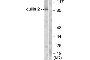Western blot analysis of extracts from LOVO cells, using Cullin 2 antibody (#C0163).
