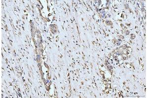 IHC analysis of MOV10 using anti-MOV10 antibody (ABIN7600236). (MOV10 Antikörper  (AA 167-772))