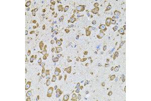 Immunohistochemistry of paraffin-embedded mouse brain using CYBB antibody. (CYBB Antikörper)