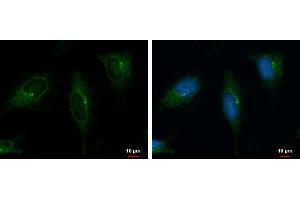 ICC/IF Image PKD2 antibody [C1C3] detects PKD2 protein at cytoplasm by immunofluorescent analysis.