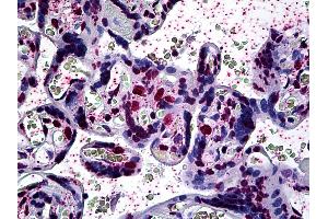 Anti-ARID3A antibody IHC of human placenta. (ARID3A Antikörper  (AA 317-417))