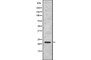 Western blot analysis IFN16 using K562 whole cell lysates (IFNA16 Antikörper)