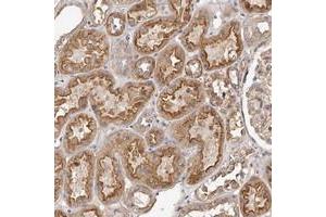 Immunohistochemical staining of human kidney with LTV1 polyclonal antibody  shows moderate cytoplasmic and membranous positivity in cells in tubules at 1:500-1:1000 dilution. (LTV1 Antikörper)
