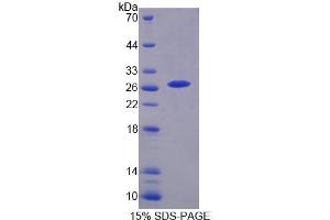 SDS-PAGE analysis of Human CHRNa3 Protein. (CHRNA3 Protein)
