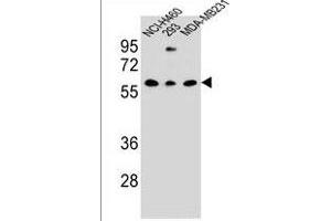 CLEC17A Antibody (C-term) (ABIN1536790 and ABIN2849828) western blot analysis in NCI-,293,MDA-M cell line lysates (35 μg/lane). (CLEC17A Antikörper  (C-Term))