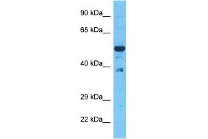 Host:  Rabbit  Target Name:  EVI2B  Sample Type:  293T Whole Cell lysates  Antibody Dilution:  1.