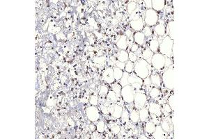 IHC analysis of TRMT61A using anti-TRMT61A antibody (ABIN7599220).