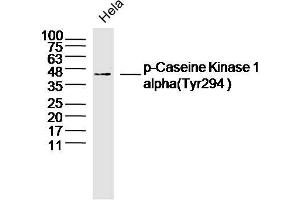 Hela lysates probed with Casein Kinase 1 alpha (Tyr294) Antibody, Unconjugated  at 1:300 dilution and 4˚C overnight incubation. (CSNK1A1 Antikörper  (pTyr294))