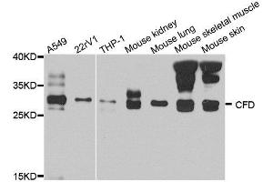 Western blot analysis of extract of various cells, using CFD antibody. (Adipsin Antikörper)