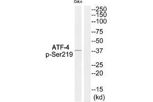 Western blot analysis of extracts from COLO cells using ATF-4 (Phospho-Ser219) Antibody. (ATF4 Antikörper  (pSer219))