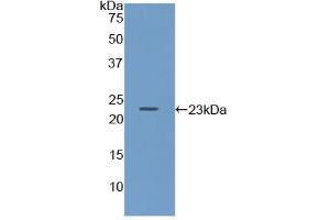 Western blot analysis of recombinant Mouse Iga. (CD79a Antikörper  (AA 30-193))