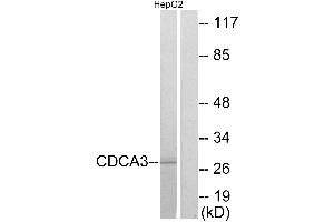 Immunohistochemistry analysis of paraffin-embedded human colon carcinoma tissue using CDCA3 antibody. (CDCA3 Antikörper)