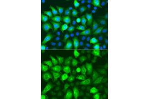 Immunofluorescence analysis of A549 cells using RRM2 antibody (ABIN5973030). (RRM2 Antikörper)
