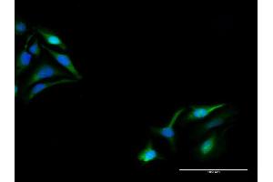 Immunofluorescence of purified MaxPab antibody to KPNA5 on HeLa cell.
