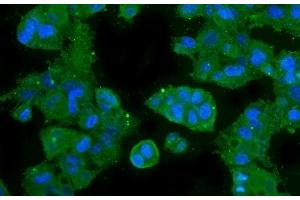 IF analysis of CA2 using anti-CA2 antibody (ABIN6719533). (CA2 Antikörper  (AA 2-260))