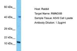 Host: Rabbit Target Name: RMND5B Sample Tissue: Human A549 Whole Cell Antibody Dilution: 1ug/ml (RMND5B Antikörper  (N-Term))