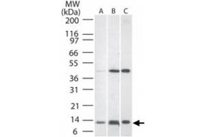 Western blot analysis of TNFRSF12A in A) human liver lysate, B) mouse liver tissue lysate, and C) rat liver lysate. (TNFRSF12A Antikörper  (AA 104-118))