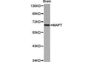 Western Blotting (WB) image for anti-Microtubule-Associated Protein tau (MAPT) antibody (ABIN1873639) (MAPT Antikörper)