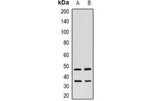 Western blot analysis of ITPK1 expression in HeLa (A), HepG2 (B) whole cell lysates. (ITPK1 Antikörper)