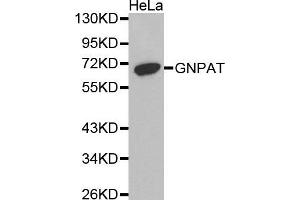 Western Blotting (WB) image for anti-Glyceronephosphate O-Acyltransferase (GNPAT) antibody (ABIN1872854) (GNPAT Antikörper)