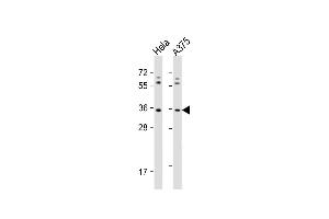 All lanes : Anti-OR5AK2 Antibody (C-term) at 1:1000 dilution Lane 1: Hela whole cell lysate Lane 2:  whole cell lysate Lysates/proteins at 20 μg per lane. (OR5AK2 Antikörper  (C-Term))