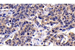 Immunohistochemistry (IHC) image for anti-Caspase 8 (CASP8) (AA 7-201) antibody (ABIN7444115)