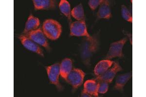 Immunofluorescence staining (rat basophils) Immunofluorescence staining of vesicles (red) in RBL-2H3 rat basophilic leukemia cell line using anti-Kinesin (KN-02).
