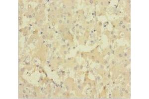 Immunohistochemistry of paraffin-embedded human liver tissue using ABIN7151627 at dilution of 1:100 (NEIL1 Antikörper  (AA 2-390))