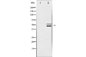 Western blot analysis of Shc expression in CalyculinA treated HeLa whole cell lysates,The lane on the left is treated with the antigen-specific peptide. (SHC1 Antikörper)