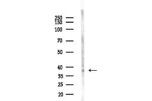 anti-Rab9 Effector Protein with Kelch Motifs (RABEPK) (Internal Region) antibody