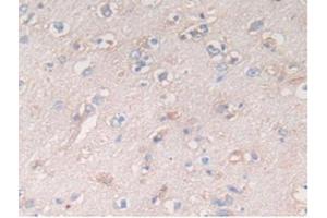 IHC-P analysis of Human Brain Tissue, with DAB staining. (ATF6 Antikörper  (AA 423-646))