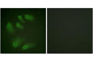 Immunofluorescence analysis of HeLa cells, using Chk1 (Phospho-Ser286) Antibody. (CHEK1 Antikörper  (pSer286))