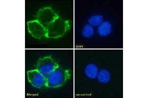 Immunofluorescence staining of fixed A431 cells with anti-EGFR antibody Matuzumab. (Rekombinanter EGFR (Matuzumab Biosimilar) Antikörper  (Extracellular Domain))