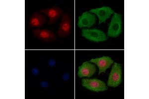 ABIN6256342 and ABIN6267479 staining Hela cells(4h of LPS treatment) by IF/ICC. (beta Catenin Antikörper  (pSer45, pThr41))