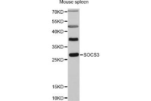 Western blot analysis of extracts of mouse spleen, using SOCS3 antibody (ABIN5970268) at 1:3000 dilution. (SOCS3 Antikörper)