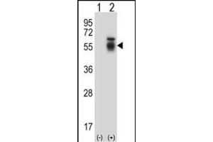 Western blot analysis of ACVR1 (arrow) using rabbit polyclonal ACVR1 Antibody (Center) (ABIN657777 and ABIN2846752).