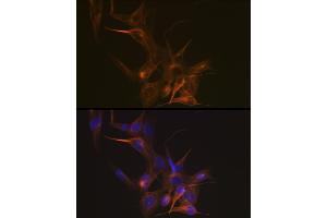 Immunofluorescence analysis of NIH-3T3 cells using Tubulin beta-1 chain Rabbit mAb (ABIN7271045) at dilution of 1:100 (40x lens). (TUBB1 Antikörper)