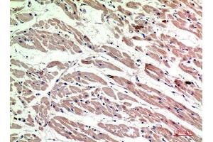 Immunohistochemistry (IHC) analysis of paraffin-embedded Human Heart, antibody was diluted at 1:200.