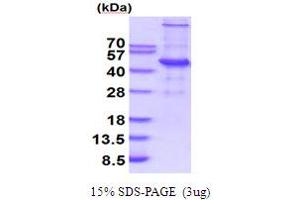 SDS-PAGE (SDS) image for Ubiquitin-Conjugating Enzyme E2Q Family Member 2 (UBE2Q2) (AA 1-375) protein (His tag) (ABIN5854280) (UBE2Q2 Protein (AA 1-375) (His tag))