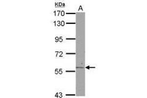 Image no. 2 for anti-Aldehyde Dehydrogenase 6 Family, Member A1 (ALDH6A1) (AA 1-255) antibody (ABIN1496604) (ALDH6A1 Antikörper  (AA 1-255))