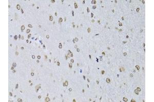 Immunohistochemistry of paraffin-embedded rat brain using LMNB2 Antibody (ABIN5973877) at dilution of 1/100 (40x lens). (Lamin B2 Antikörper)
